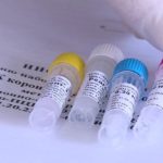 Ульяновская область в аутсайдерах по количеству тестируемых на коронавирус в ПФО